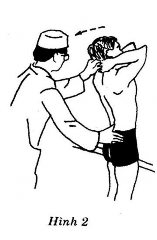 Thầy thuốc Đứng thẳng ở phía sau của người bệnh một tay tóm chắc hai bàn 2