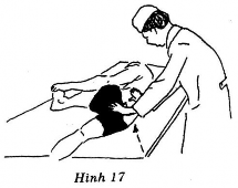 Thầy thuốc Đứng cúi ngang trọng điểm phía sau lưng người bệnh hai cánh tay 10