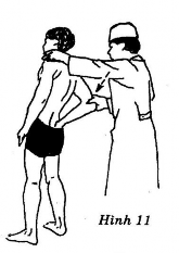 Giải tỏa các đốt sống bị dính cứng khu trú trong vùng thắt lưng và hông từ 4