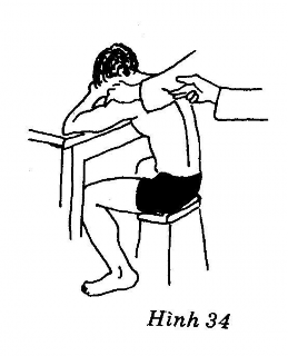 Tư thế Người bệnh Ngồi cong gù lưng vòng hai cánh tay đặt trên bàn đầu cúi 9