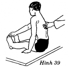 Thầy thuốc Đứng phía sau người bệnh một tay ở tư thế tự do một cánh tay co 1