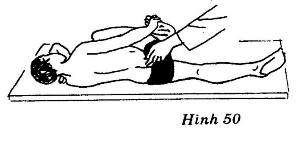 Áp dụng thủ thuật xoay và đẩy theo hướng chếch từ ngoài vào trong đối với 12