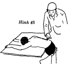 Người bệnh Nằm sấp ngang giường thân mình trườn trên giường đùi và chân 7