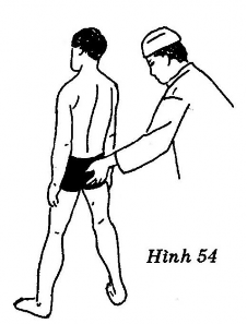 Giải tỏa trọng điểm vùng cụt có hình thái lệch Tư thế Người bệnh Đứng 2