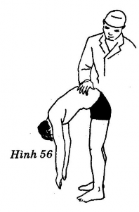 Giải tỏa trọng điểm không quy định vùng trên hệ cột sống hình thái gai 4