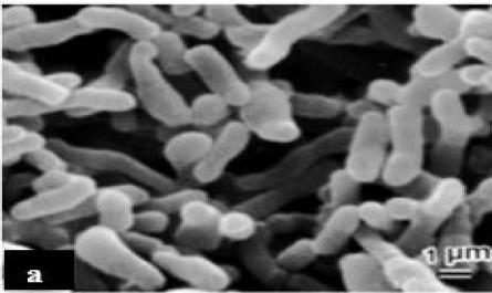 Cơ Chế Gây Bệnh Trứng Cá Vi Khuẩn Propionibacterium Acnes