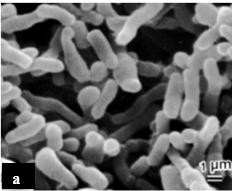 Hình 2 2 Vi khuẩn P acnes Jappe et al 2002 a Hình chụp dưới kính hiển vi điện tử b 1