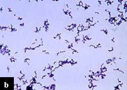 Hình 2 2 Vi khuẩn P acnes Jappe et al 2002 a Hình chụp dưới kính hiển vi điện tử b 2