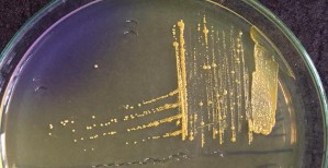 a Hình 4 1 Khuẩn lạc dòng vi khuẩn phân lập trên môi trường TYEG agar có bổ sung 1