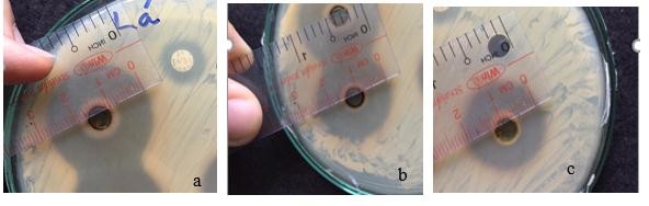 Hình 4 8 Vòng vô khuẩn của cao chiết ethanol lá Trứng cá ức chế vi khuẩn P acnes 12