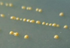 a Hình 4 1 Khuẩn lạc dòng vi khuẩn phân lập trên môi trường TYEG agar có bổ sung 2