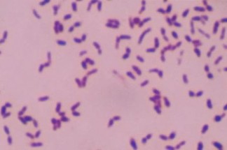 Hình 4 2 Hình thái tế bào vi khuẩn P acnes dưới kính hiển vi 4 1 2 2 Kết quả 3