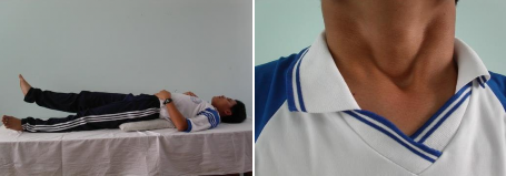 H 2 Động tác Thở 4 thời có kê mông 3 Động tác 3 Ưỡn cổ  Chuẩn bị Hai tay 1