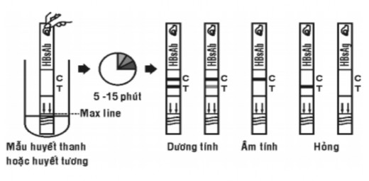 Hình 2 1 Hướng dẫn sử dụng test HBsAg Hepatitis B surface antigen test 98 Xét 1