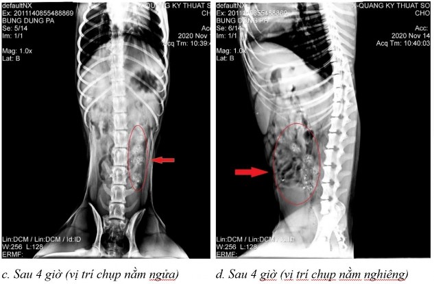 Hình 3 27 Hình ảnh X quang của chó 1 ở thời điểm a sau 2 giờ 20 ở vị trí nằm 6