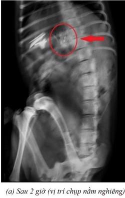 Nằm ngửa c sau 7 giờ ở vị trí nằm ngửa và d sau 9 giờ ở vị trí nằm ngửa 11