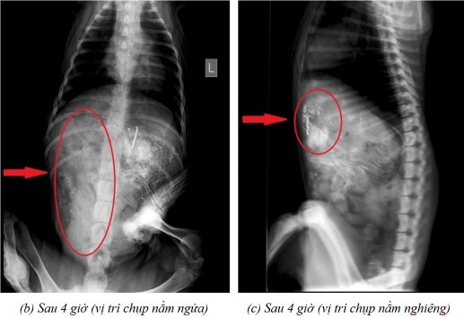Nằm ngửa c sau 7 giờ ở vị trí nằm ngửa và d sau 9 giờ ở vị trí nằm ngửa 12