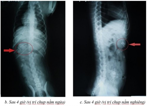 Phụ lục 5 1 Hình ảnh X quang chó 2 ở thời điểm a sau 2 giờ ở vị trí nằm 5