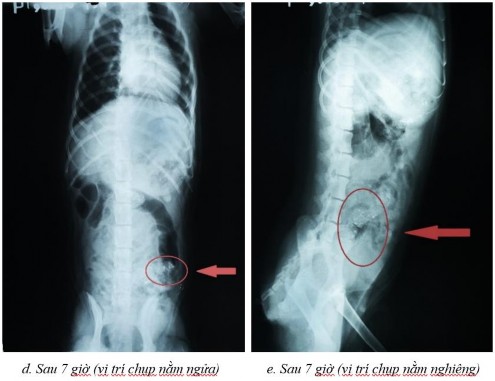 Phụ lục 5 1 Hình ảnh X quang chó 2 ở thời điểm a sau 2 giờ ở vị trí nằm 6