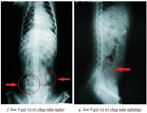 Phụ lục 5 1 Hình ảnh X quang chó 2 ở thời điểm a sau 2 giờ ở vị trí nằm 7