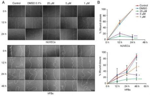 Figure 7 Oxostephanine inhibits the migration of hUVECs and hFBs A Images of cell migration toward 2