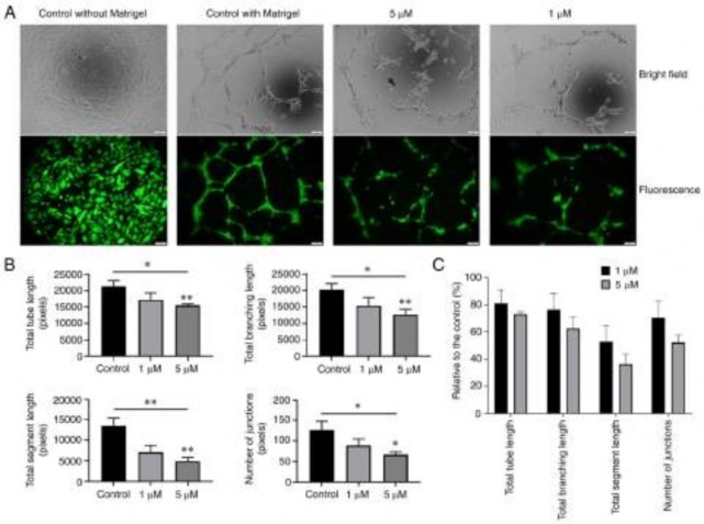 Figure 8 Effect of osxostephanine on the tube formation assay of hUVECs A Representative images and 3