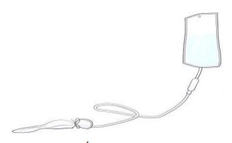 Hình 1 5 Ống thông có bao cao su 1 8 Phương pháp thực hiện bóng chèn lòng tử cung 1