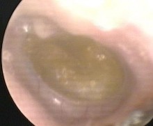 Ảnh 12 MN dính vào ụ nhô khớp đe đạp MSBA 1901263977 12