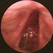 Ảnh 2 KHVM dạng C 1 bên MSBA 1906297842 Ảnh 3 KHVM dạng C 2 bên MSBA 1809237546 Ảnh 4 2