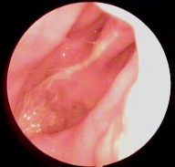 Ảnh 3 KHVM dạng C 2 bên MSBA 1809237546 Ảnh 4 KHVM dạng D 2 bên MSBA 1806217649 Hình 3