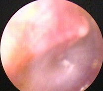 Ảnh 7 MN lõm trắng đục MSBA 1904282049 Ảnh 8 MN lõm vàng MSBA 1912331936 Ảnh 9 MN 7