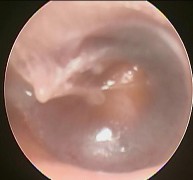 Ảnh 8 MN lõm vàng MSBA 1912331936 Ảnh 9 MN lõm xanh MSBA 1806217636 Ảnh 10 MN xẹp chưa 8