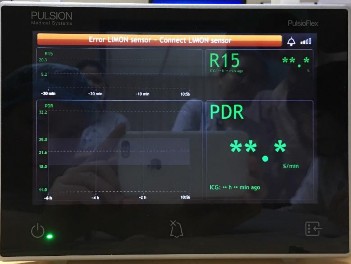 Hình 1 2 Máy đo độ thanh lọc ICG bằng phương pháp LiMON 1 2 Lựa chọn bệnh nhân 1