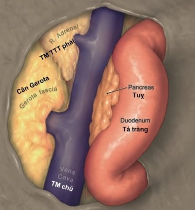 Hình 1 8 Liên quan giải phẫu TTT phải với cơ quan trong phúc mạc Nguồn Lim S K Rha 2