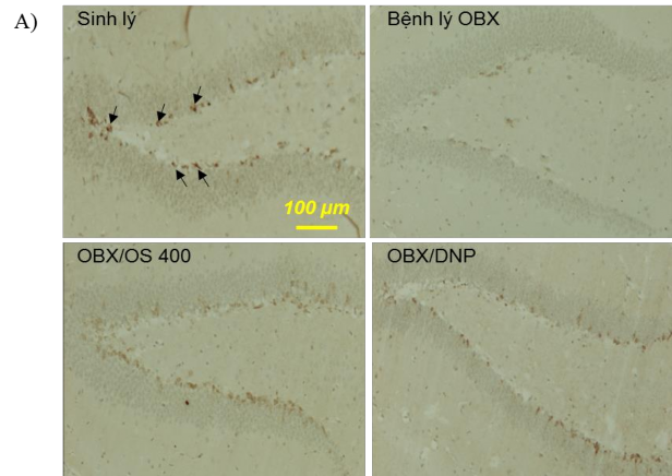 Hình 3 4 Số lượng tế bào dương tính với DCX ở vùng hồi răng hồi hải mã 1