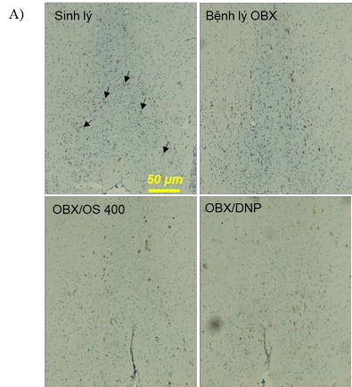Hình 3 5 Số lượng tế bào dương tính với ChAT ở vách giữa của các lô A Hình 3