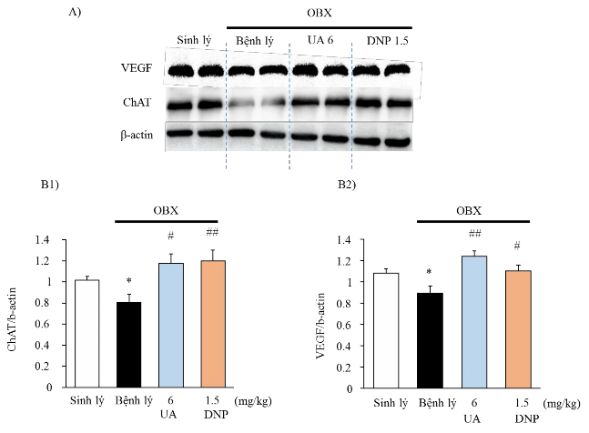 Hình 3 17 Ảnh hưởng của UA lên biểu hiện protein ChAT và VEGF trong hồi hải mã 9