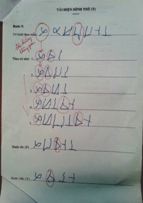 Hình 3 5 Kết quả thực hiện phần ghi nhớ thị giác ở học sinh CPT vùng não 1