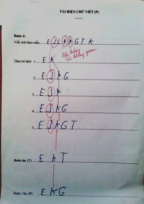 Hình 3 5 Kết quả thực hiện phần ghi nhớ thị giác ở học sinh CPT vùng não 2