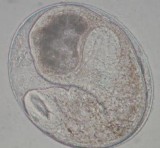 Hình 3 4 Ấu trùng nang sán lá gan nhỏ thu thập từ cá nước ngọt nuôi tại ao cá 2