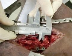 C D Hình 3 51C Lực gập 18kg Hình 3 51D Khoảng cách liên mỏm gai 11mm sau khi treo tạ 2