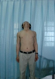 NGHIÊNG BÊN CƠ CỔ KHÔNG TEO SẸO CỔ TỐT Trường hợp 4 Họ tên Trương Văn Th 4