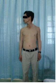 NGHIÊNG BÊN CƠ CỔ KHÔNG TEO SẸO CỔ TỐT Trường hợp 4 Họ tên Trương Văn Th 5