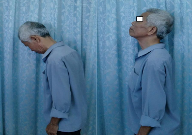 PHỤC HỒI VẬN ĐỘNG TAY CHÂN Tay P phục hồi cơ lực 4 năng được vật nhẹ 3