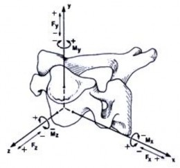 Hình 1 7 Các kiểu di lệch cột sống trong không gian 3 chiều Nguồn White Panjabi 1990 1