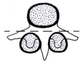 Hình 1 10 Ba cột của Louis 1 cột trước và 2 cột sau Nguồn Louis 1985 Anatomy clinics 10