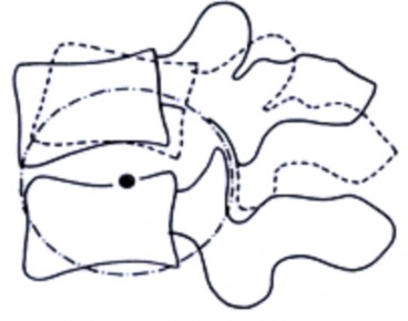 Hình 1 8 Trục xoay – IAR Nguồn White Panjabi 1990 J Fed Med Bio Eng 118 Tay đòn Tay đòn 4