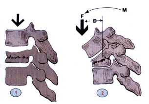 Hình 1 9 Sức mạnh của tay đòn 1 Lực ép trên trục xoay tay đòn ngắn lực 7