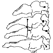 Hình 1 34 Phương pháp Roger buộc 1 sợi chỉ 76 102 103 Nguồn Roger 1957 JBJS 39A 103 1 3 5