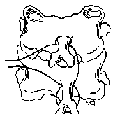 Hình 1 35 Phẫu thuật Bohlman kỹ thuật 3 sợi chỉ Nguồn Bohlman 1985 JBJS 9 42 1 3 5 3 6